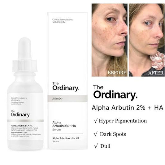 THE ORDINARY ALPHA ARBUTINE 2% +HA